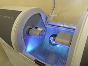 Cerec Crown Sculpturing Technology available at Traverse Family Dentistry.